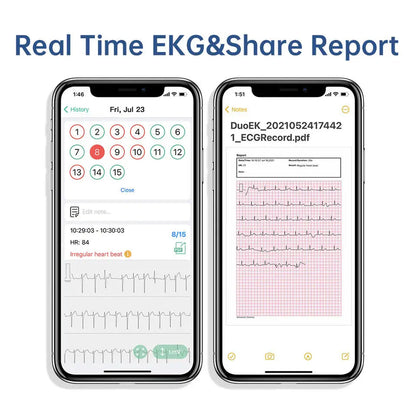 Pocket ECG Monitoring Device in Personal Health Care