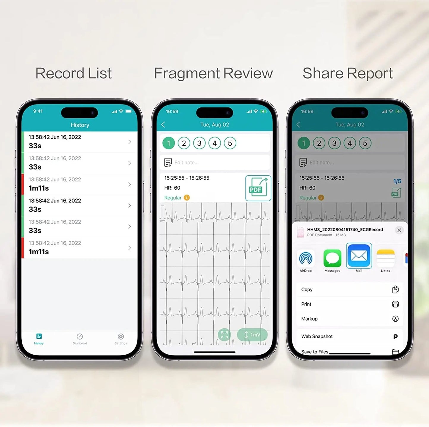 Pocket ECG Monitoring Device in Personal Health Care