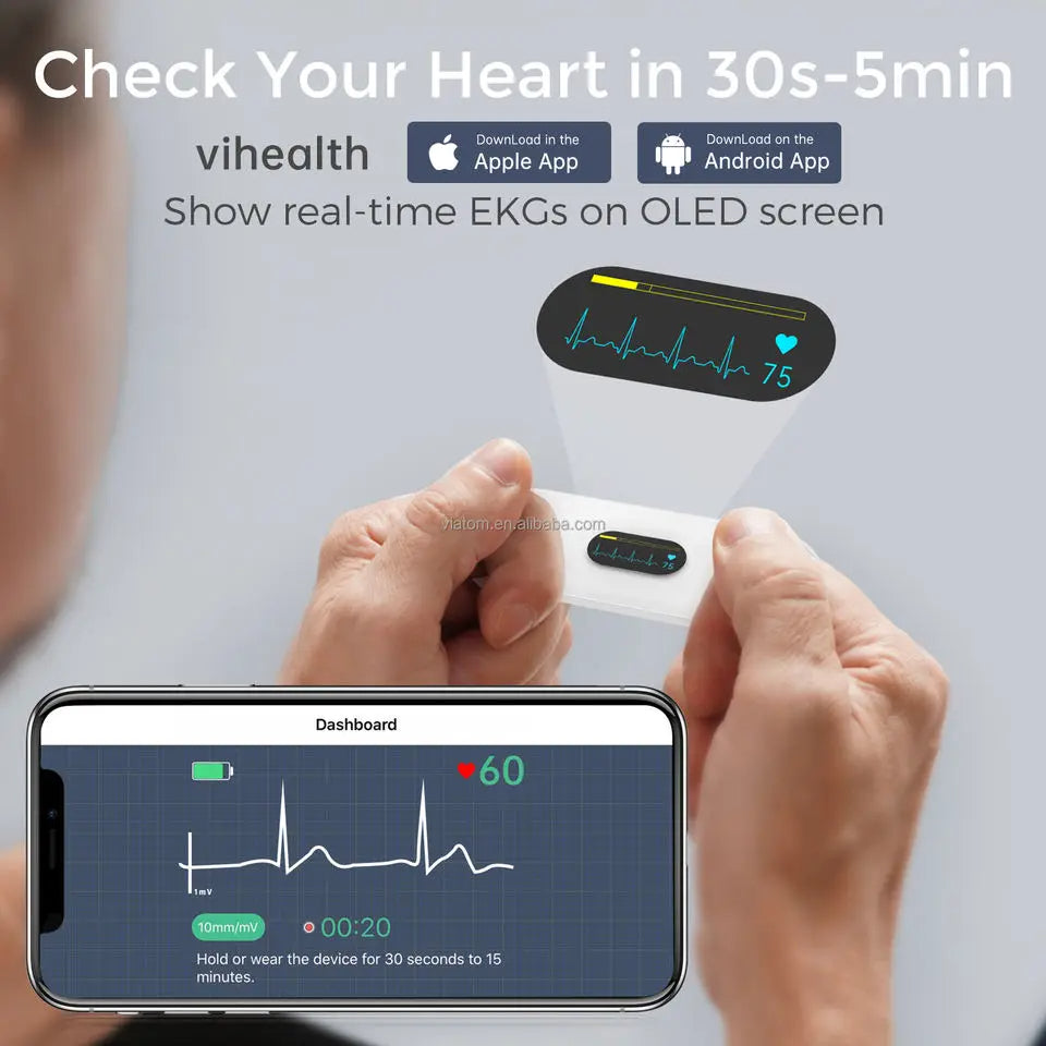 Pocket ECG Monitoring Device in Personal Health Care